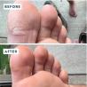 VOESH Heel Repair Duo | Bálsamo + Calcetines Hidratantes para Talones