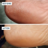 VOESH Heel Repair Duo | Bálsamo + Calcetines Hidratantes para Talones