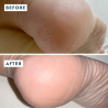 VOESH Heel Repair Duo | Bálsamo + Calcetines Hidratantes para Talones